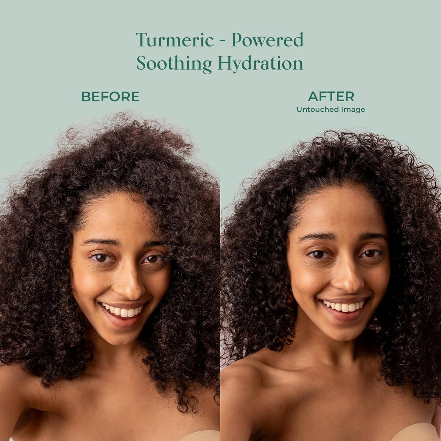 SHAZ & KIKS Ultra Hydrating Turmeric Shampoo | Sulfate-Free Shampoo for Dry, Itchy, Flaky Scalp |