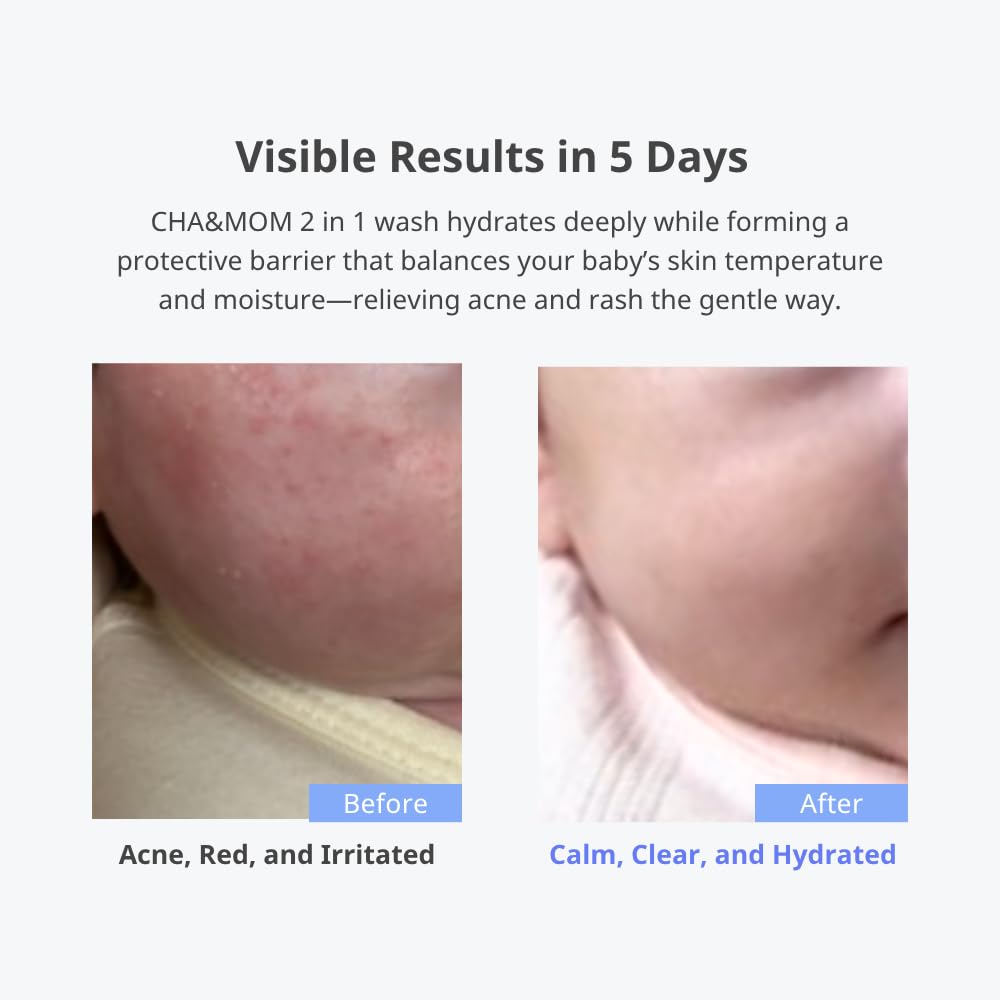 Cha&Mom Head-to-toe Korean Baby Skincare - Hypoallergenic, Plant Based, and Natural Hair & Body
