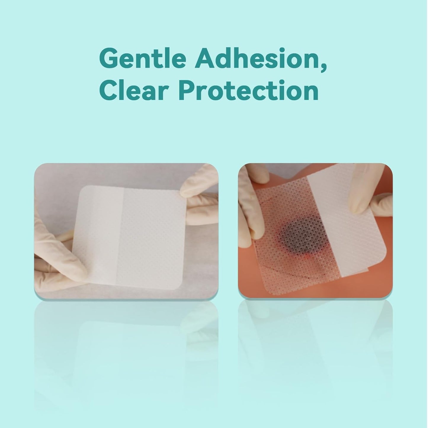 Dimora Silicone Wound Contact Layer, Non-adhering Dressing, Transparent Wound Dressing Pads, 3in x