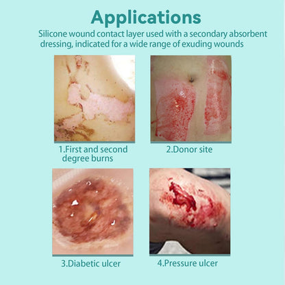 Dimora Silicone Wound Contact Layer, Non-adhering Dressing, Transparent Wound Dressing Pads, 3in x