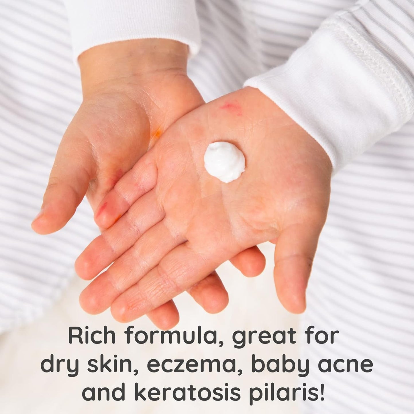 Bubbsi Whipped Coconut Oil Baby Lotion for Eczema, Dry Skin, Baby Acne, KP | Organic Coconut Oil