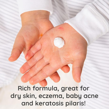 Bubbsi Whipped Coconut Oil Baby Lotion for Eczema, Dry Skin, Baby Acne, KP | Organic Coconut Oil