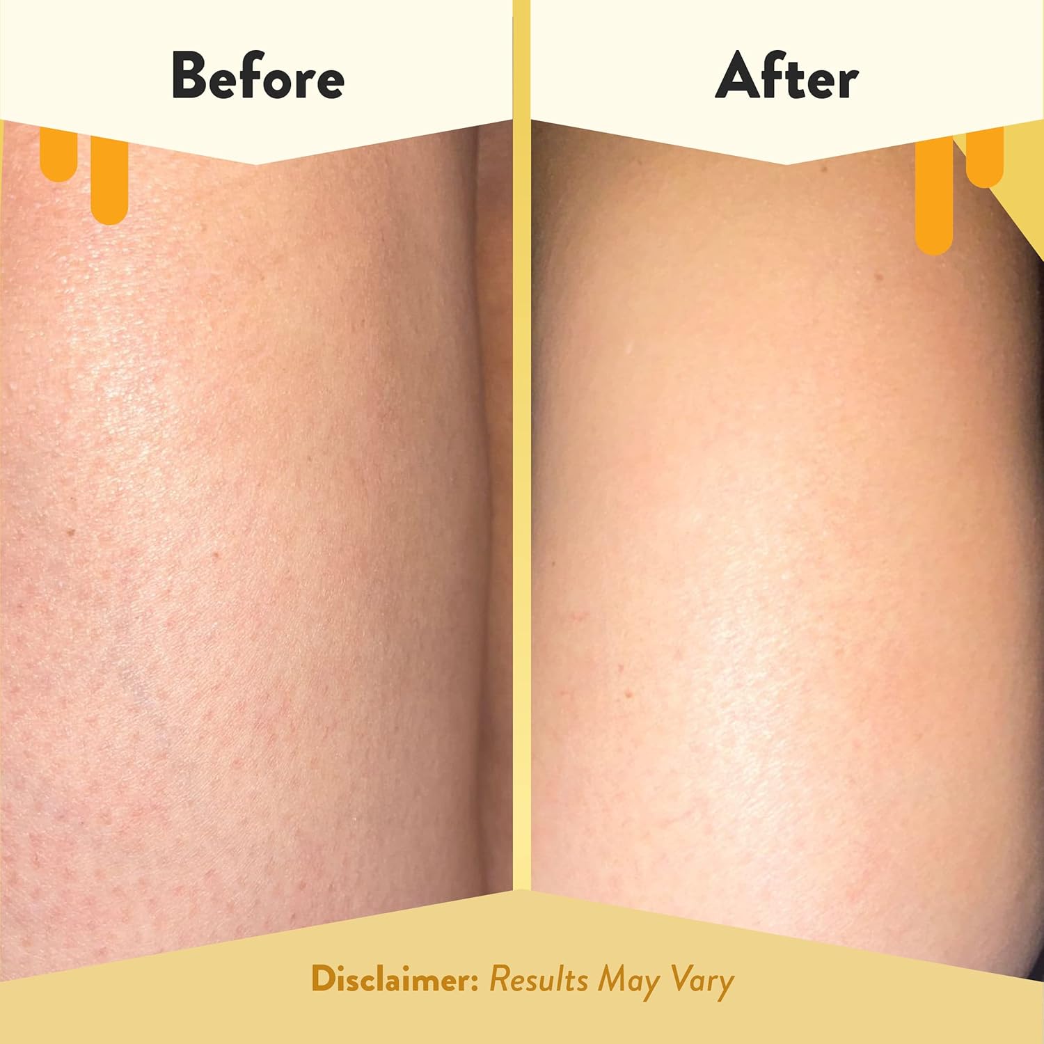 ECZEMA HONEY Soothing Body Wash - Daily Shower Gel & Eczema Treatment - Sensitive Skin Body Wash