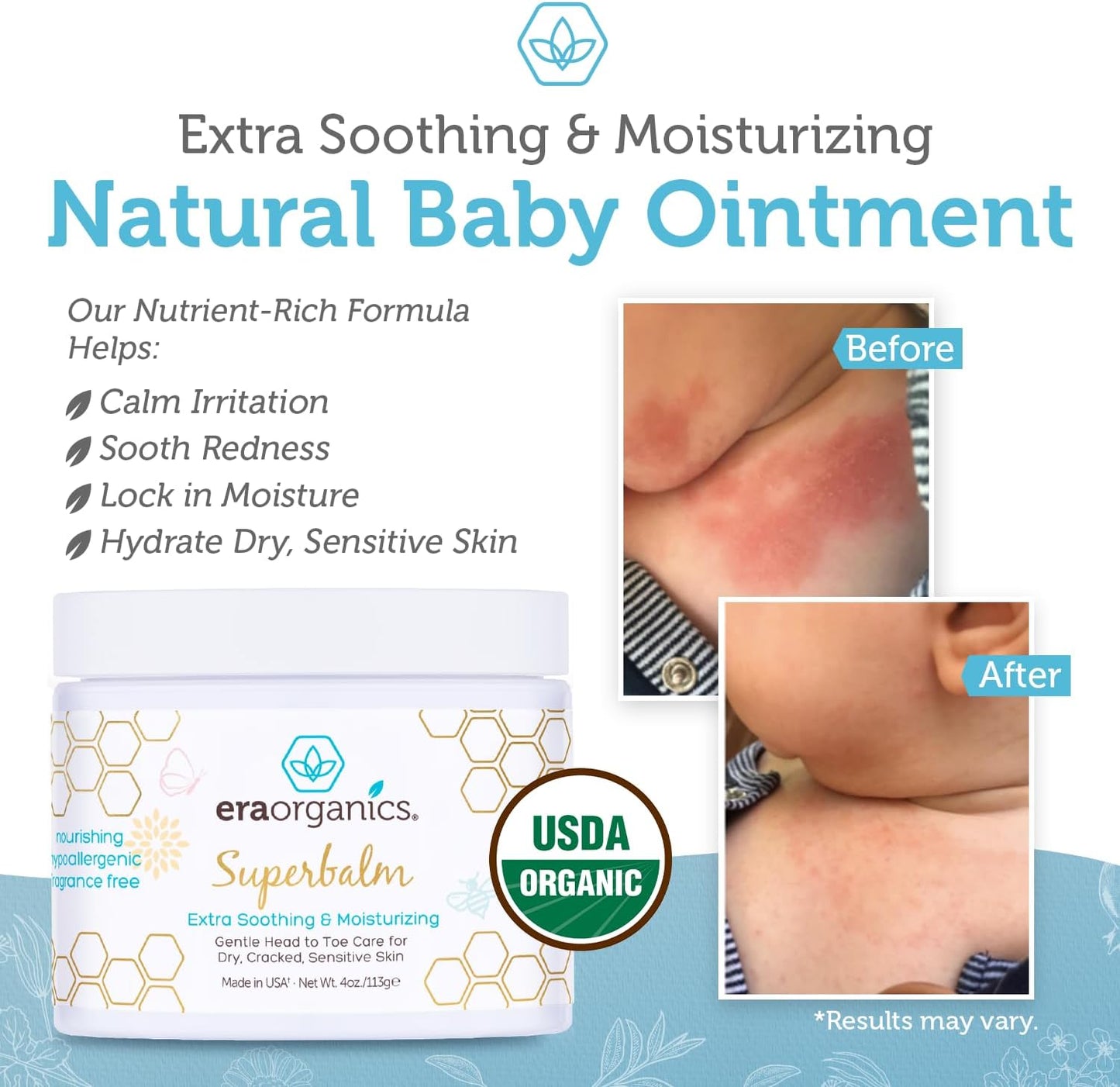 Era Organics Healing Ointment for Babies - USDA Certified Organic Natural Moisturizer Gentle on Sensitive Skin Prone To Baby Eczema, Cradle Cap (Infant Seborrheic Dermatitis), Rashes, Hives 4oz